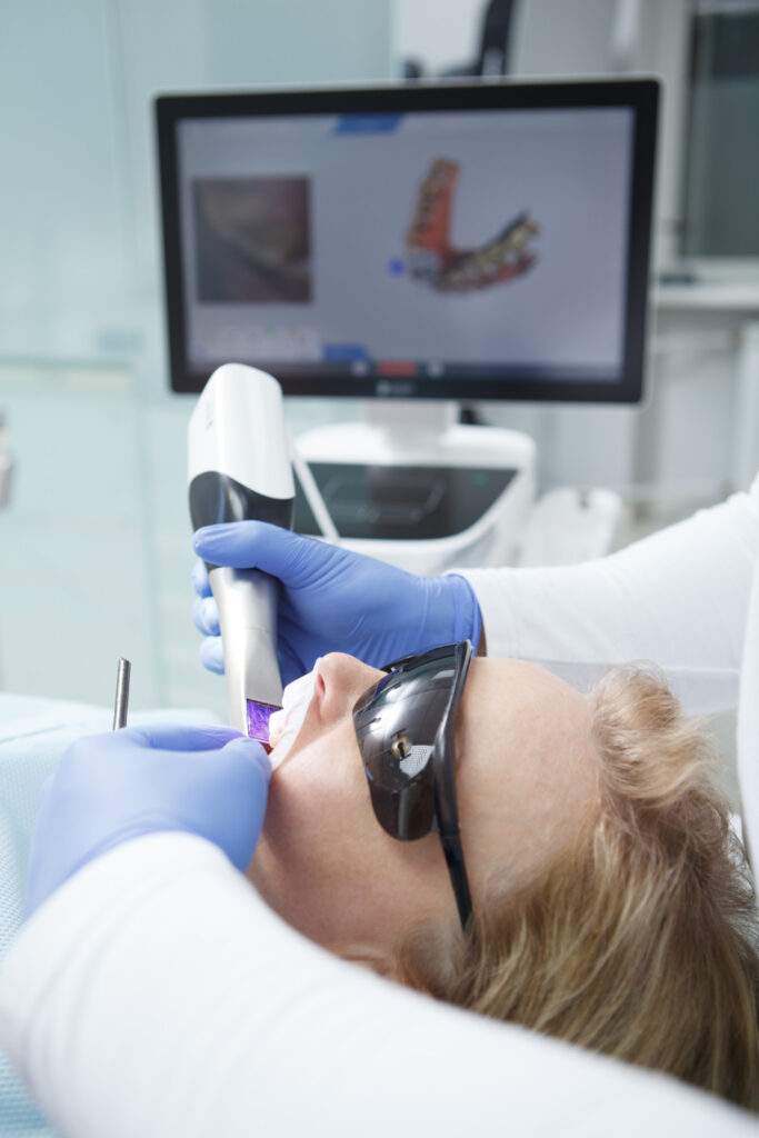 Escáner intraoral