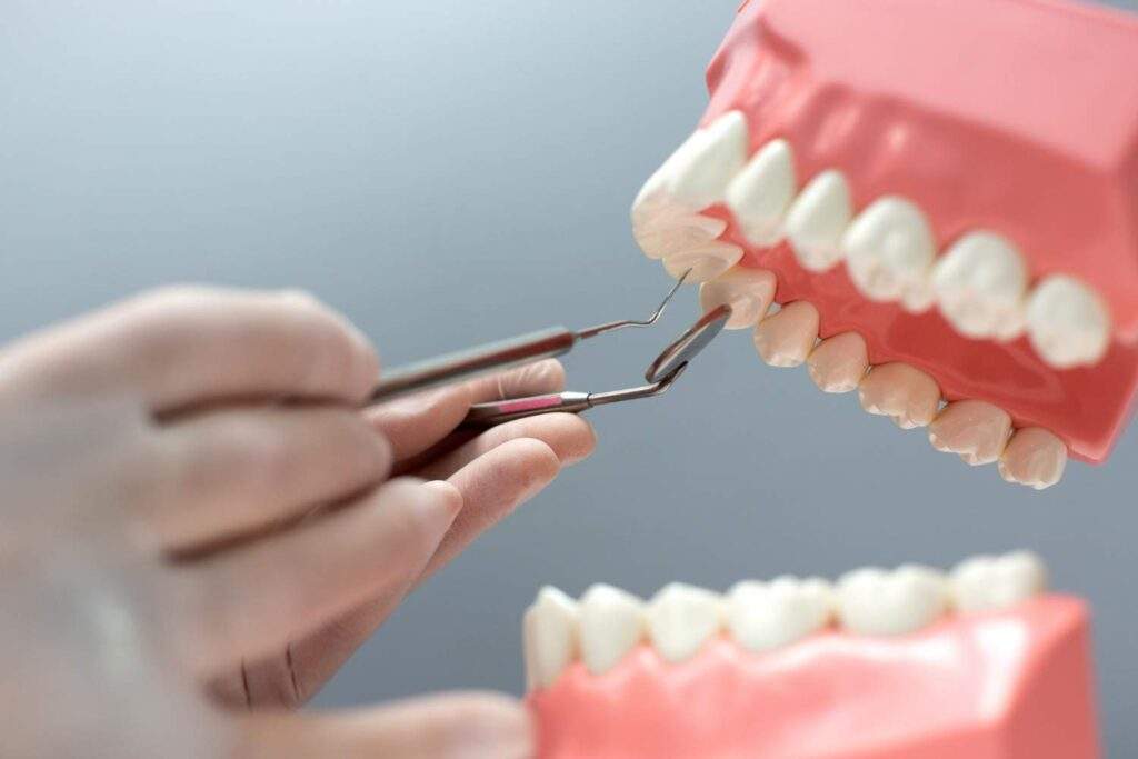 Dentista practicando con implantes dentales en Sant Boi de Llobregat