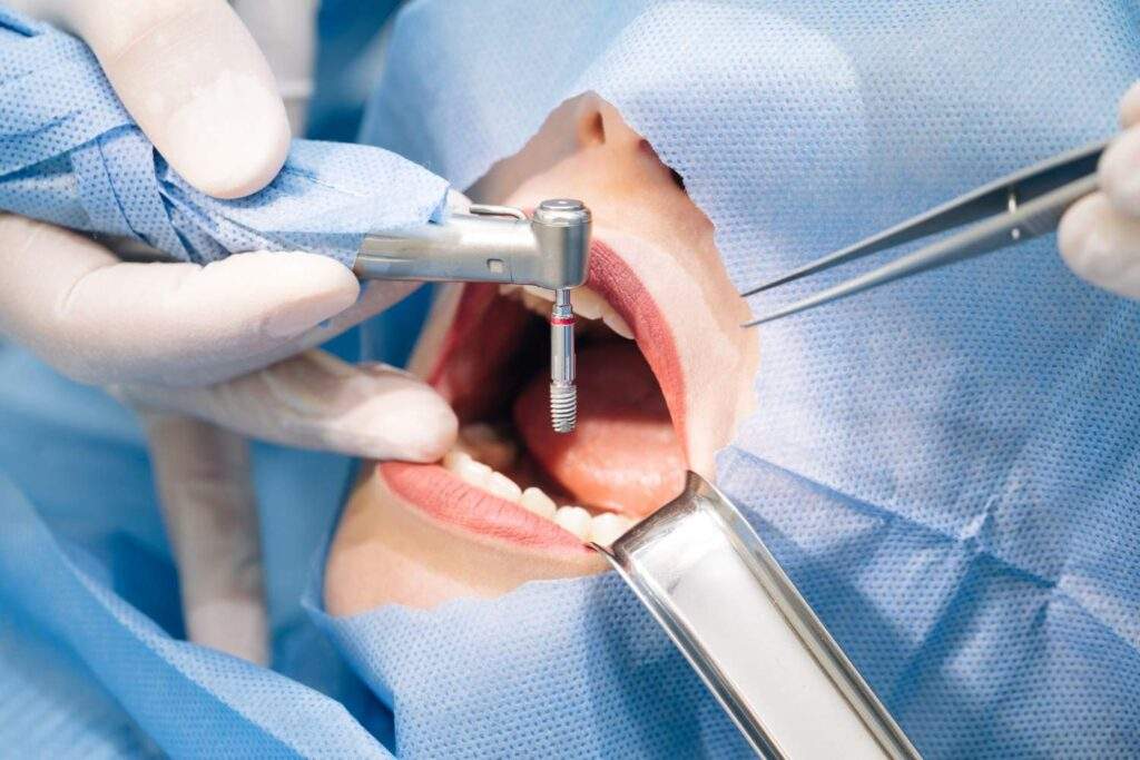 Cirugía dental de confianza en Sant boi de LLobregat